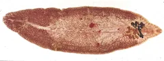 Fasciolopsis buski