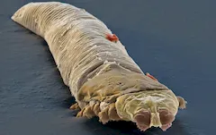 Nużeniec ludzki (Demodex folliculorum)