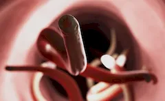 Tęgoryjec brazylijski (Ancylostoma brasiliensis)