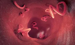 Węgorek jelitowy (strongyloides stercoralis)